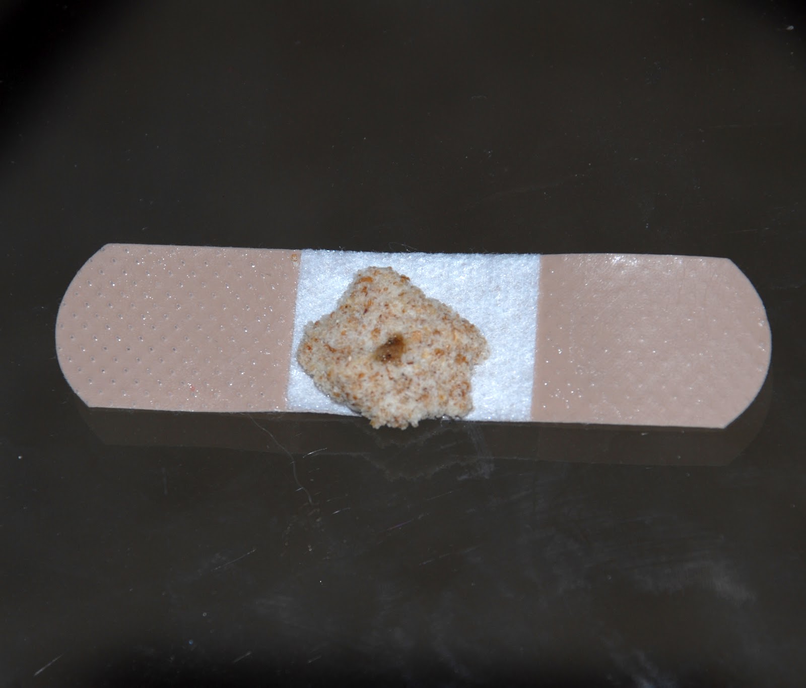 Remove A Splinter Without Tweezers! It Keeps Getting Better