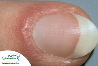 ���� ������ �� ����� ������ ������� ���� ������ �� ���� ������ ������ �������