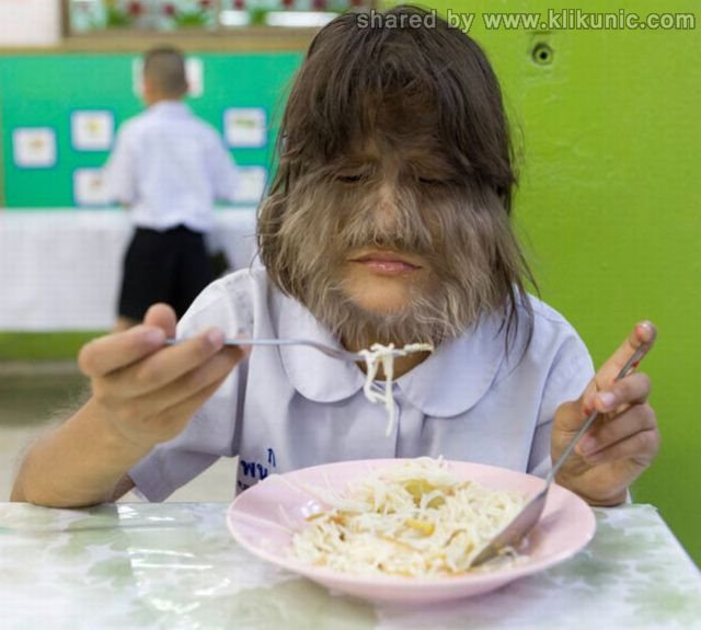 http://2.bp.blogspot.com/-fiVn915Uqzo/TW-vr995KXI/AAAAAAAAPwk/qCFiIQqZ-DY/s1600/the_worlds_hairiest_640_03.jpg