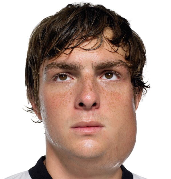 mumps+swelling.jpg