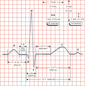 Estudio de un electrocardiograma