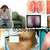 Obat Ambeien Herbal Murah Tapi Manjur thumbnail