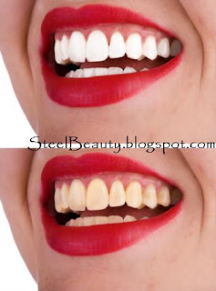 كيفية تبيض الأسنان والحفاظ على الأسنان بيضاء %25D8%25AA%25D8%25A8%25D9%258A%25D8%25B6+%25D8%25A7%25D9%2584%25D8%25A3%25D8%25B3%25D9%2586%25D8%25A7%25D9%2586+%25D9%2588%25D8%25A7%25D9%2584%25D8%25AD%25D9%2581%25D8%25A7%25D8%25B8+%25D8%25B9%25D9%2584%25D9%2589+%25D8%25A3%25D8%25B3%25D9%2586%25D8%25A7%25D9%2586+%25D8%25A8%25D9%258A%25D8%25B6%25D8%25A7%25D8%25A1
