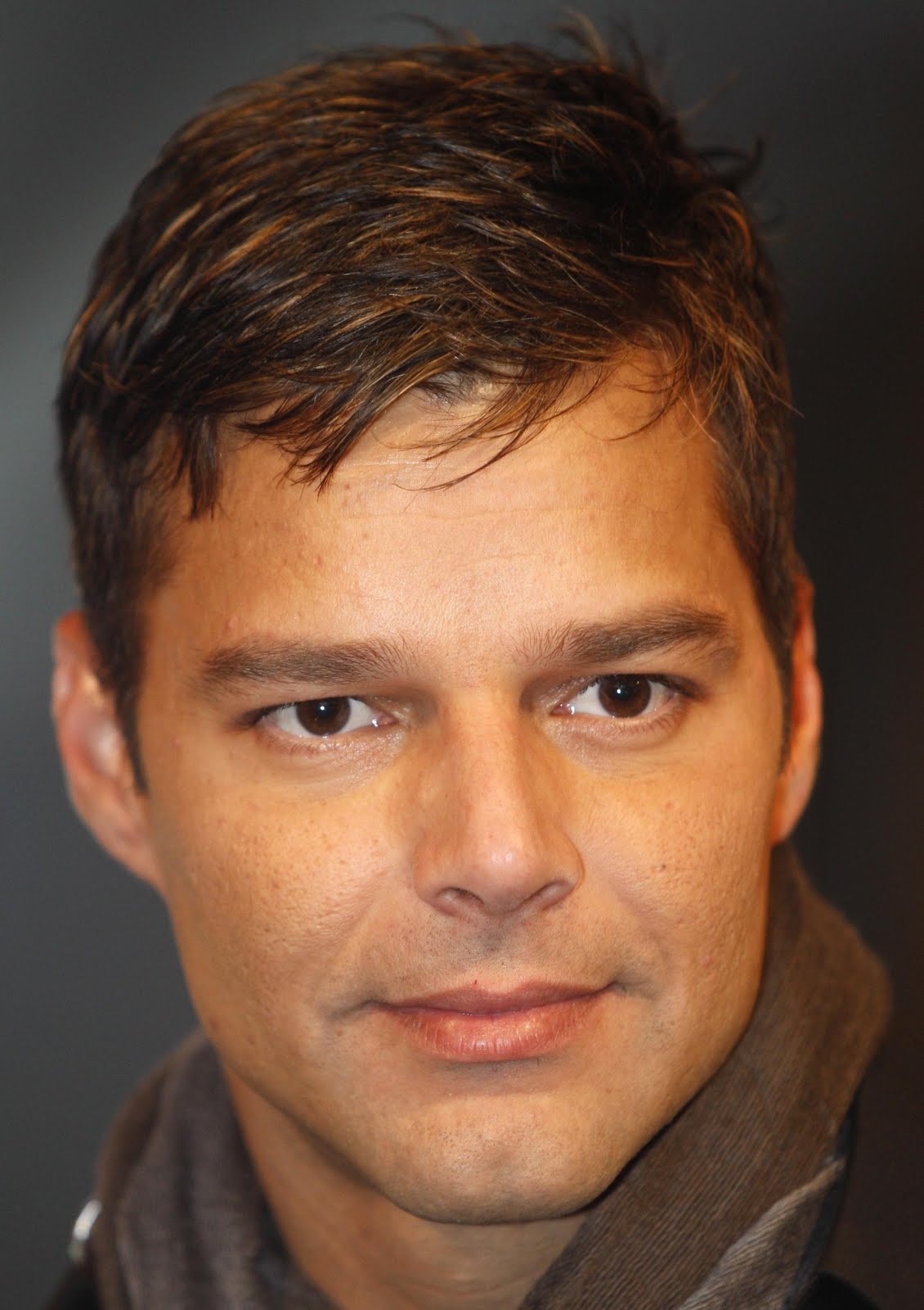 http://2.bp.blogspot.com/-fvdrlypknpU/Tg3HqIkqOGI/AAAAAAAAA_Q/-YafpQnBYdg/s1600/ricky-martin-acne-2.jpg