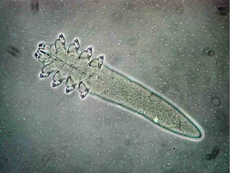 Human Demodex