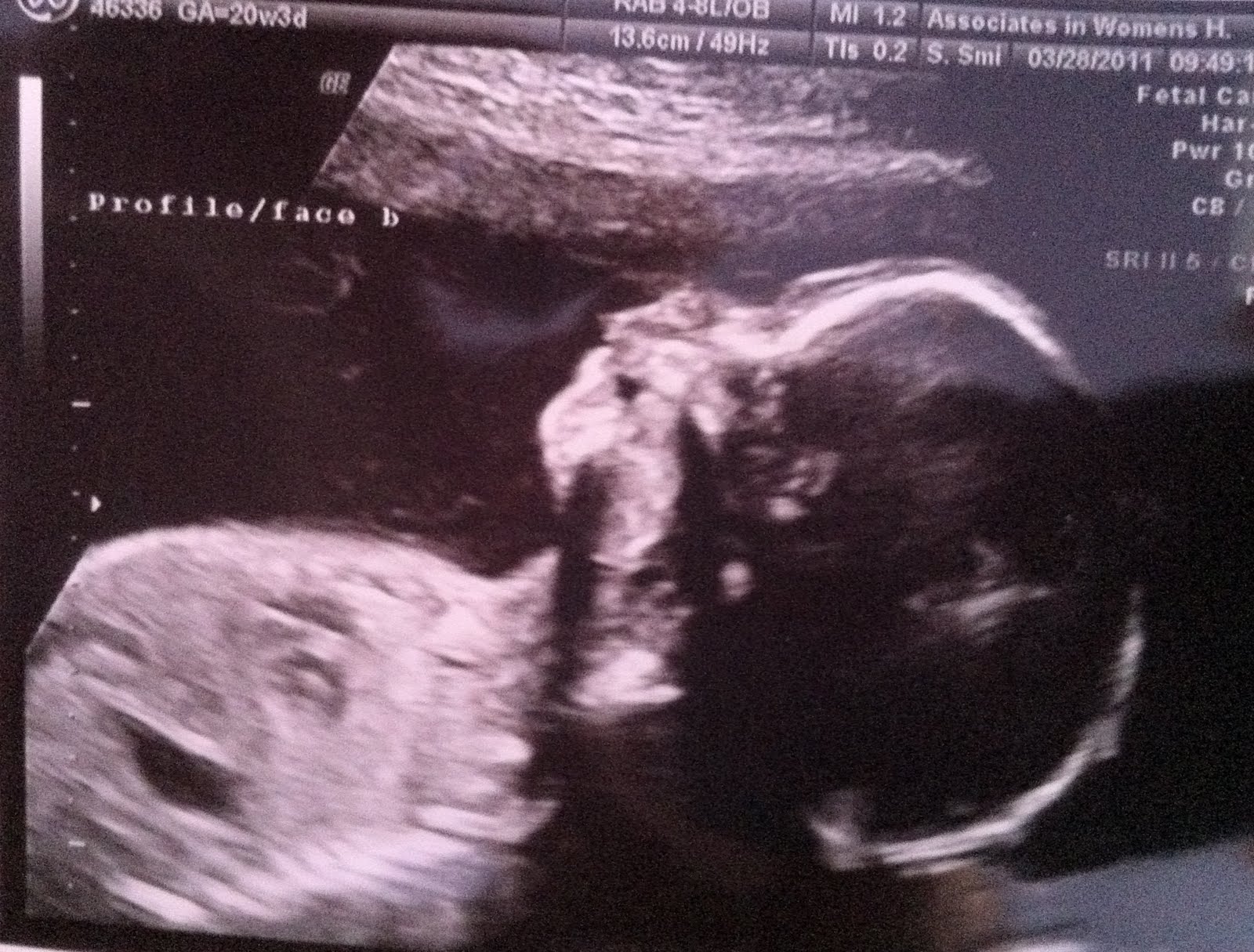 Baby Wilcox 2.... and 3 20 week appointment/ ultrasound
