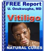 Vitiligo FREE REPORT
