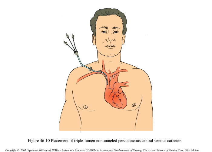 Appearance of a central venous