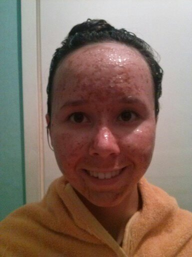You Take Do Off Face Your Pimples How You Take Do Off Face Your Pimples How