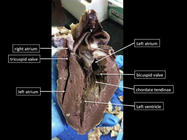 Girls Rock Bio  Sheep Heart Dissection