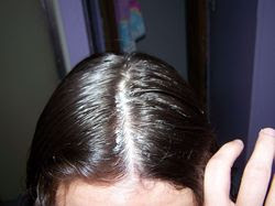 monistat growth hair scalp absorbed already being parts its