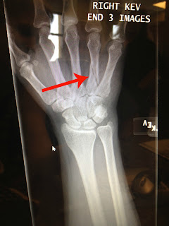 x-ray