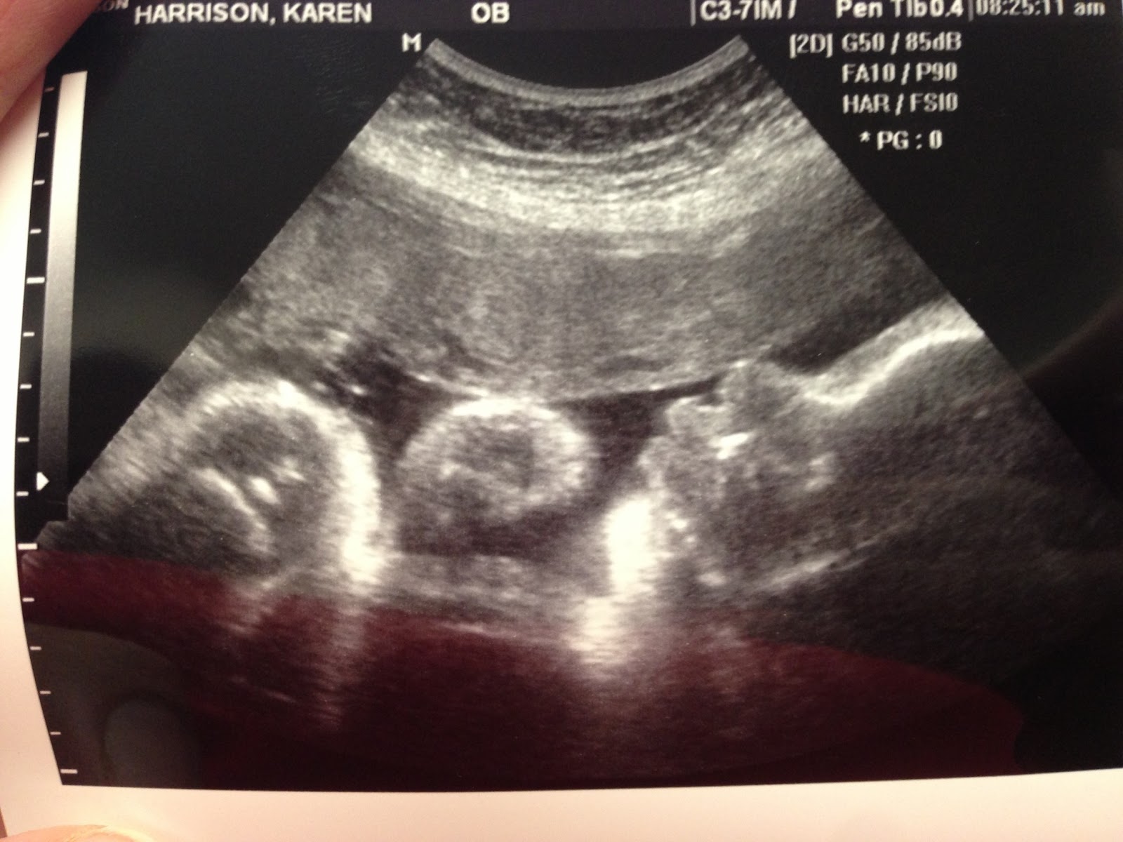 Our Family Faith Walk 36 weeks!!!