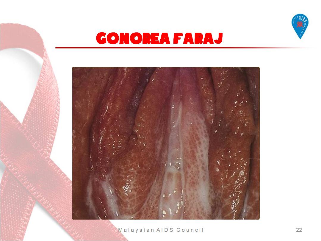 Sila klik imej untuk visual yang lebih jelas.
