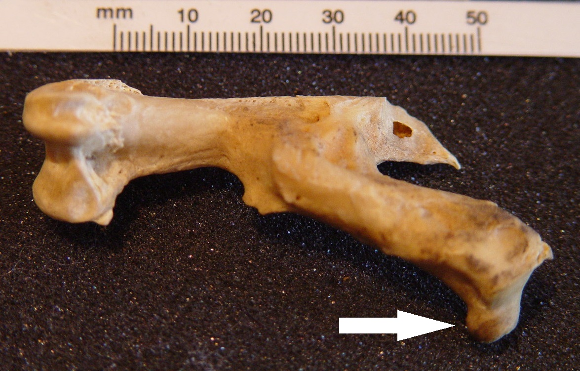 Femur Fractures So who was the victim?-2.bp.blogspot.com