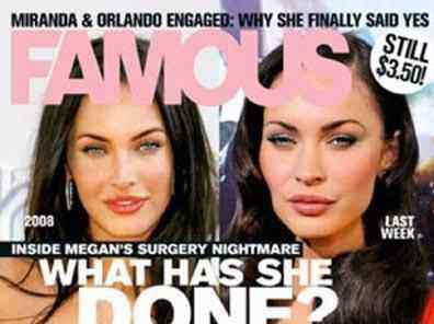megan fox plastic surgery before and after