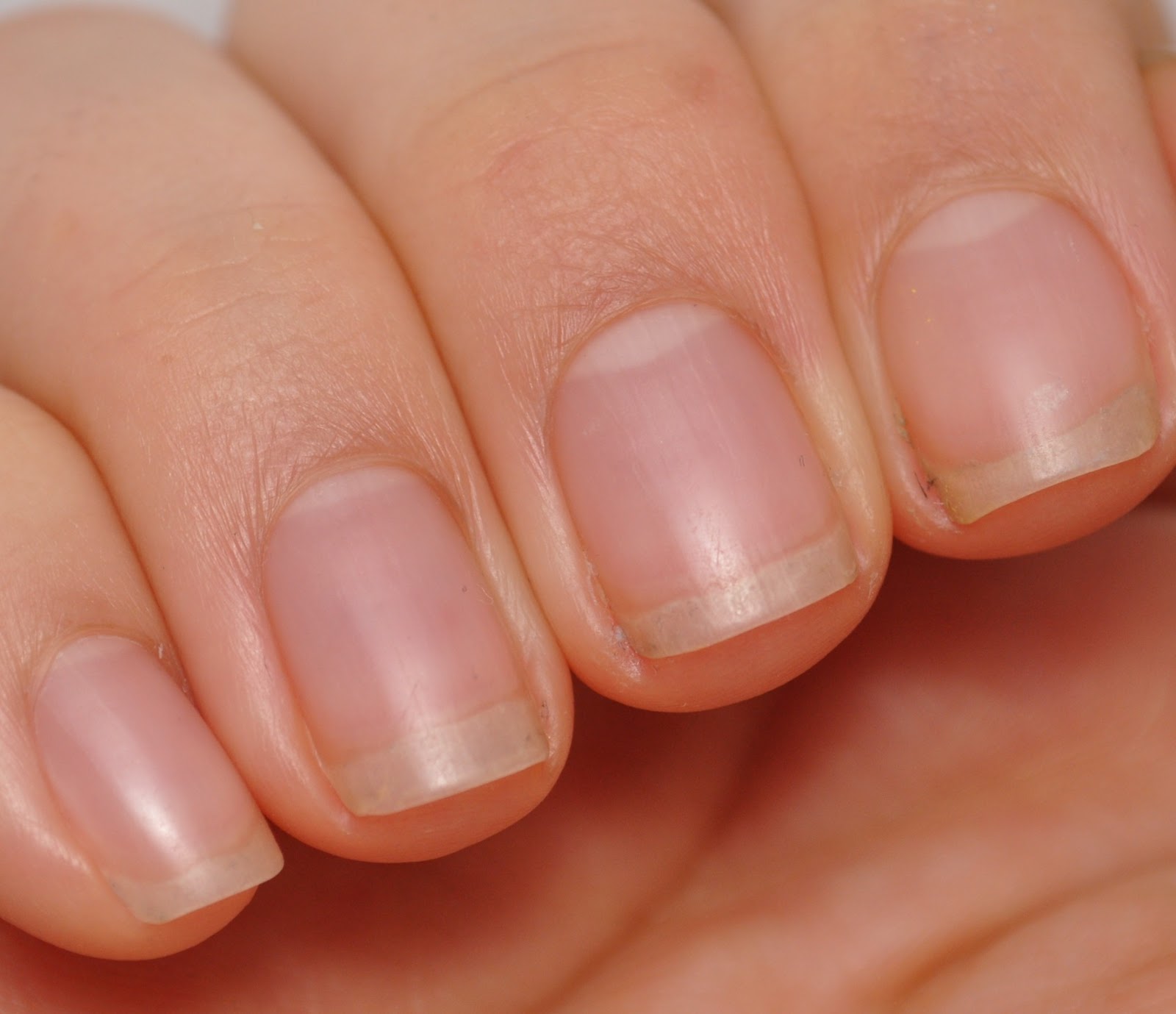 What are my cuticles supposed to look like? I think I missed that day in Nails 101 r