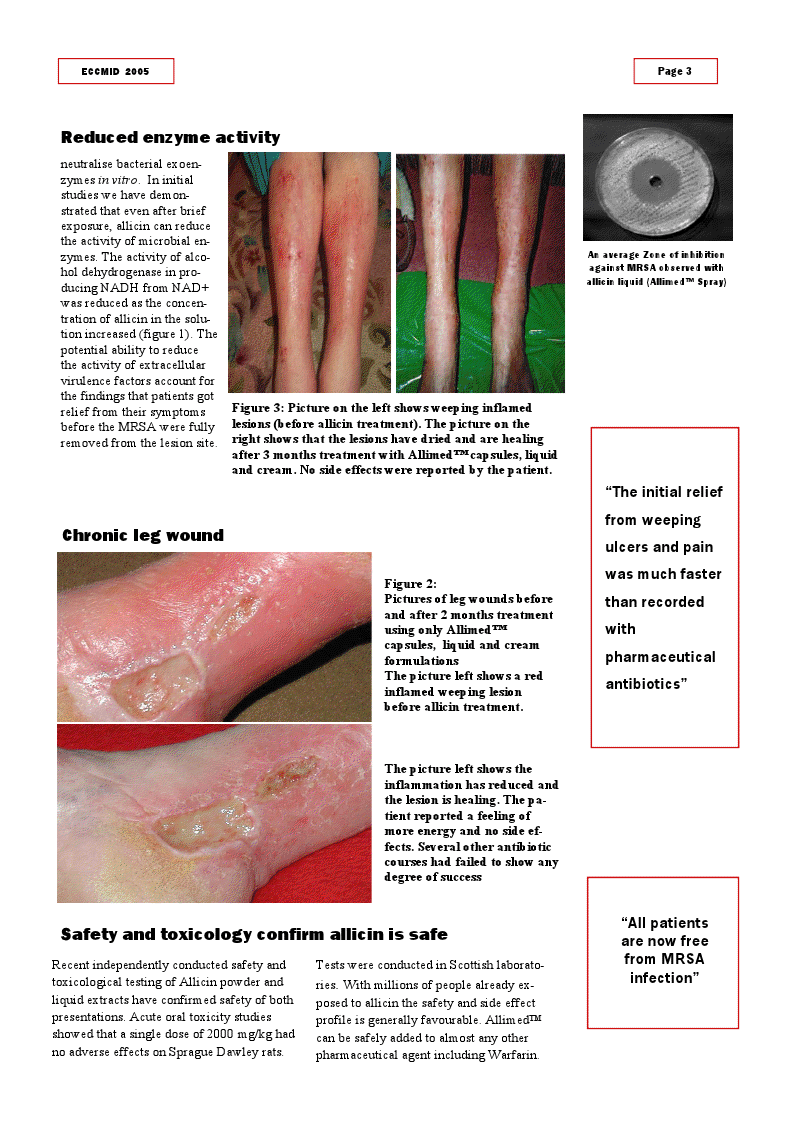 research paper on mrsa Mrsa essays: over 180,000 mrsa essays, mrsa term papers, mrsa research paper, book reports 184 990 essays, term and research papers available for unlimited access. research paper on mrsa Mrsa essays: over 180,000 mrsa essays, mrsa term papers, mrsa research paper, book reports 184 990 essays, term and research papers available for unlimited access.
