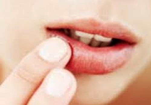 Bibir Kering Dan Pecah-Pecah Ketahui Penyebab Serta Cara Mengatasi Bibir Kering Dan Pecah-Pecah