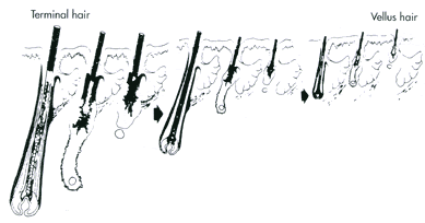 Tips For Beauty Hair Convert Vellus Hair Into Terminal Hair With