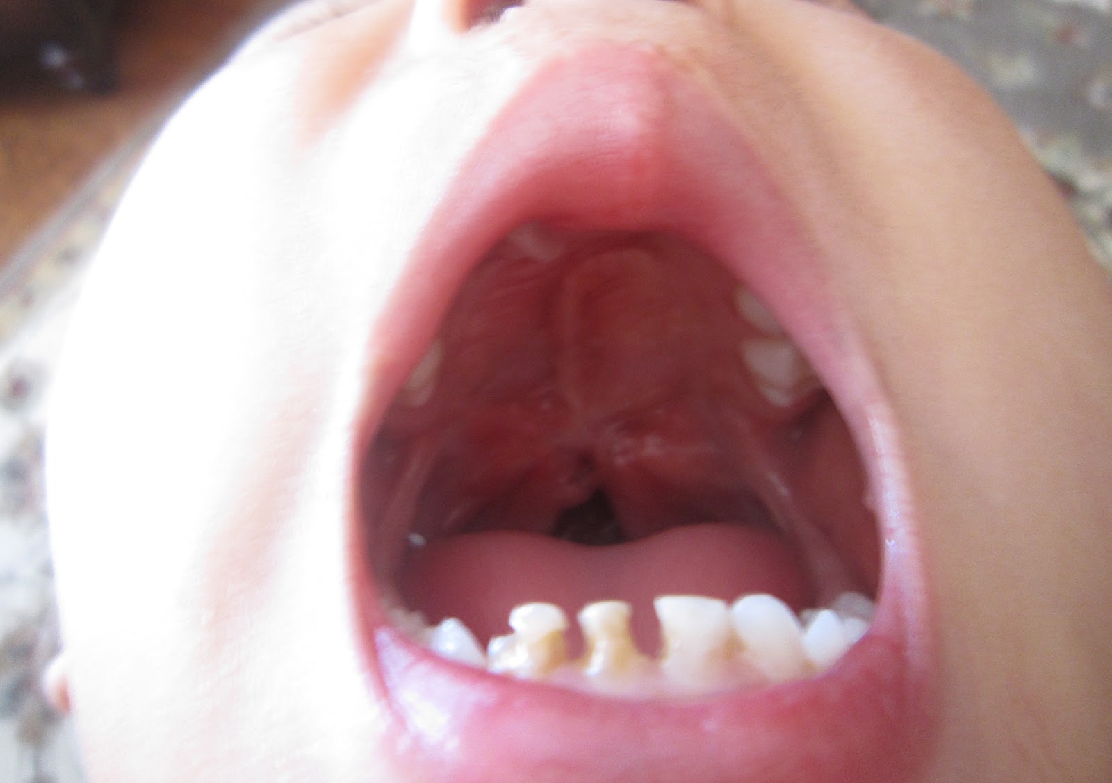 Patterns Of Soft Palate Movements In Six Languages