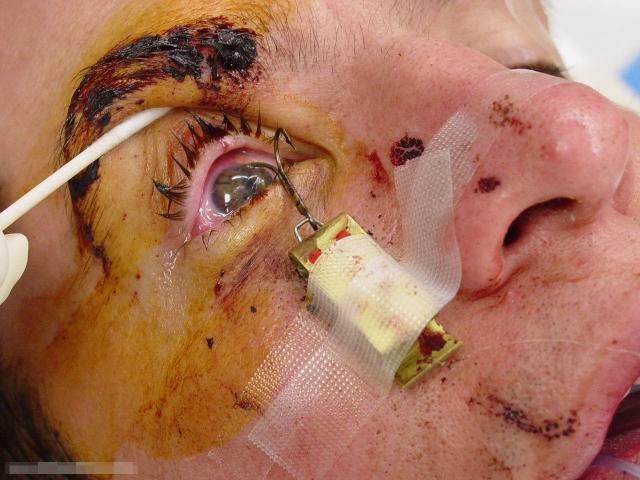 Filme - Quebra de Conduta Mbius - 2013