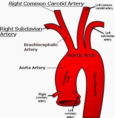 Right Common Carotid Artery