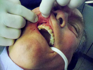 Mobile Kodgers: DENTAL WORK IN MEXICO------HOW EXPENSIVE?---HOW GOOD?