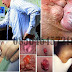 Obat Ambeien Herbal Terpopuler thumbnail