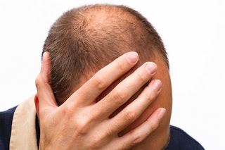 7 Ways to Prevent Baldness With It