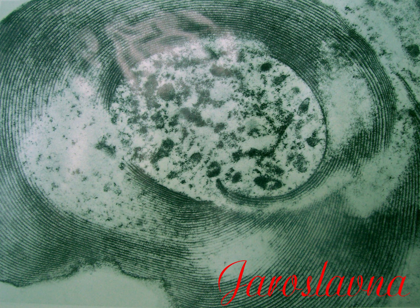 Признаки лямблиоза у детей | Наши дети - Советы родителям ...