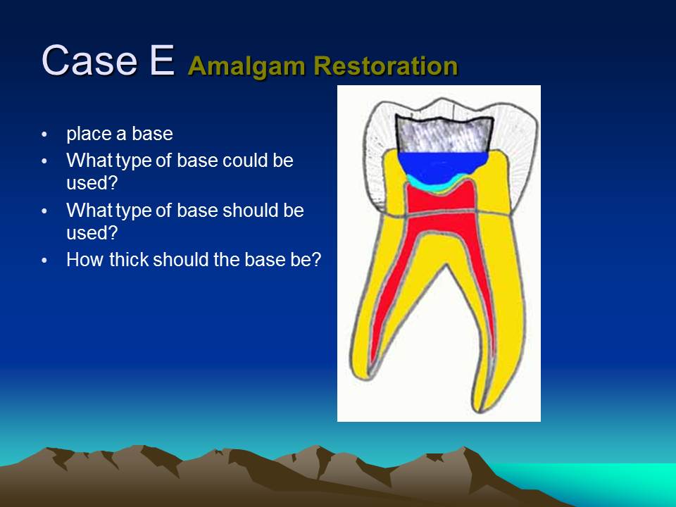 Dentistry Sealers, Liners and Bases