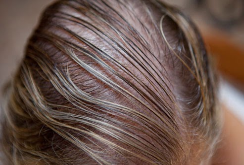 How To Get Rid Of Thin Hair Naturally Indian Beauty Touch