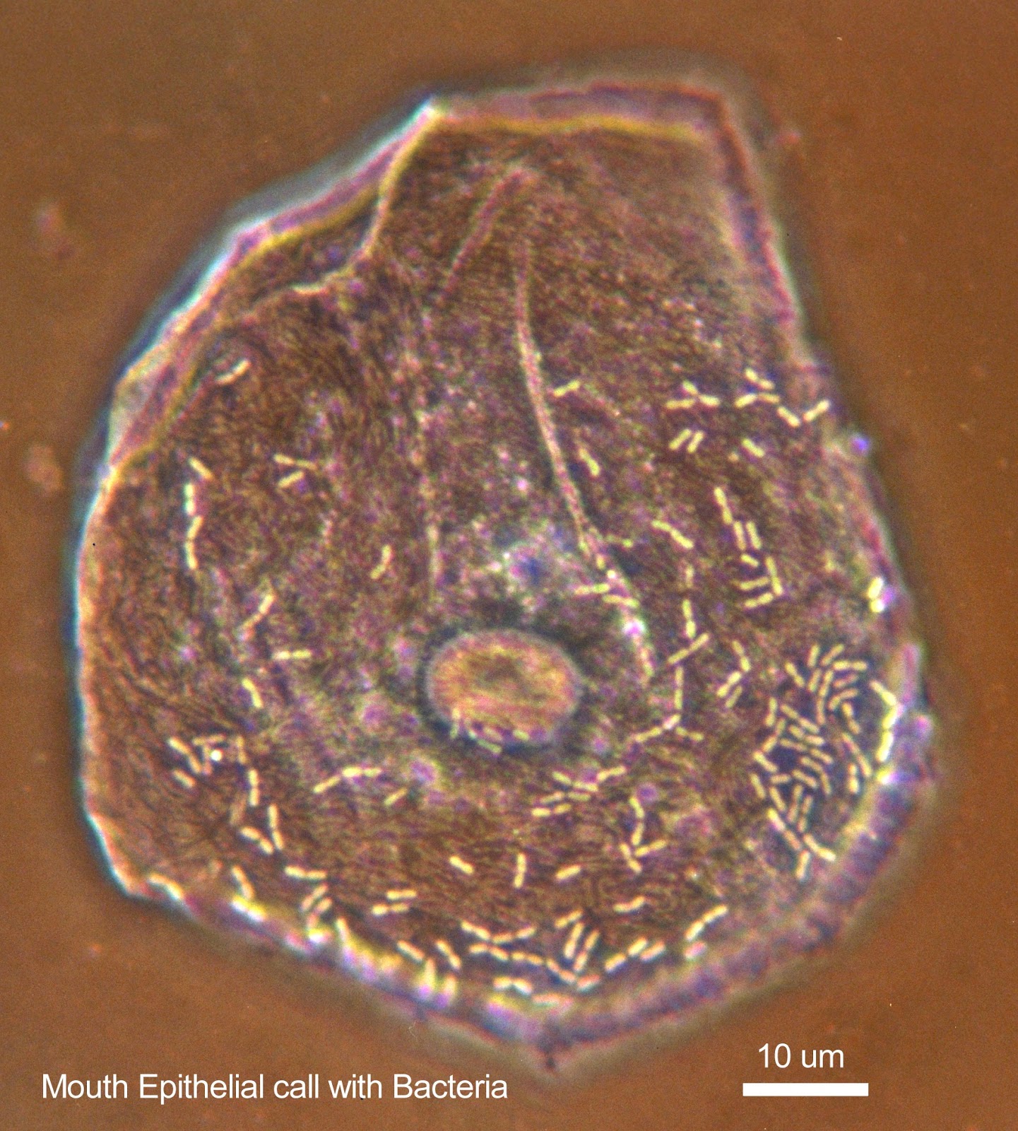 Miltoncontact Finding lowcontrast microbiological specimens under the