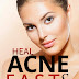 Heal Acne Fast & Naturally - Free Kindle Non-Fiction
