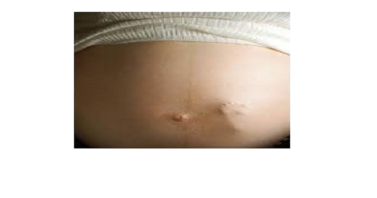 5 Weeks Pregnant Five Weeks Pregnant Symptoms