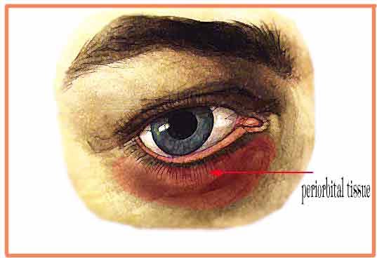 How to get rid of bags under eyes for men ?: Anatomical definition of