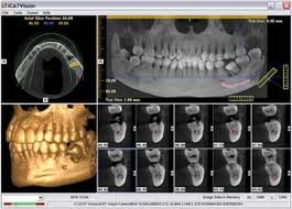 3d Cone Beam Scan Technology Seabreeze Dental Group