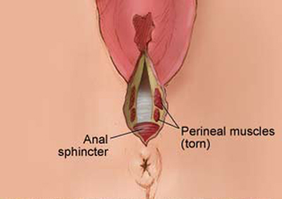 How do you know your testosterone level