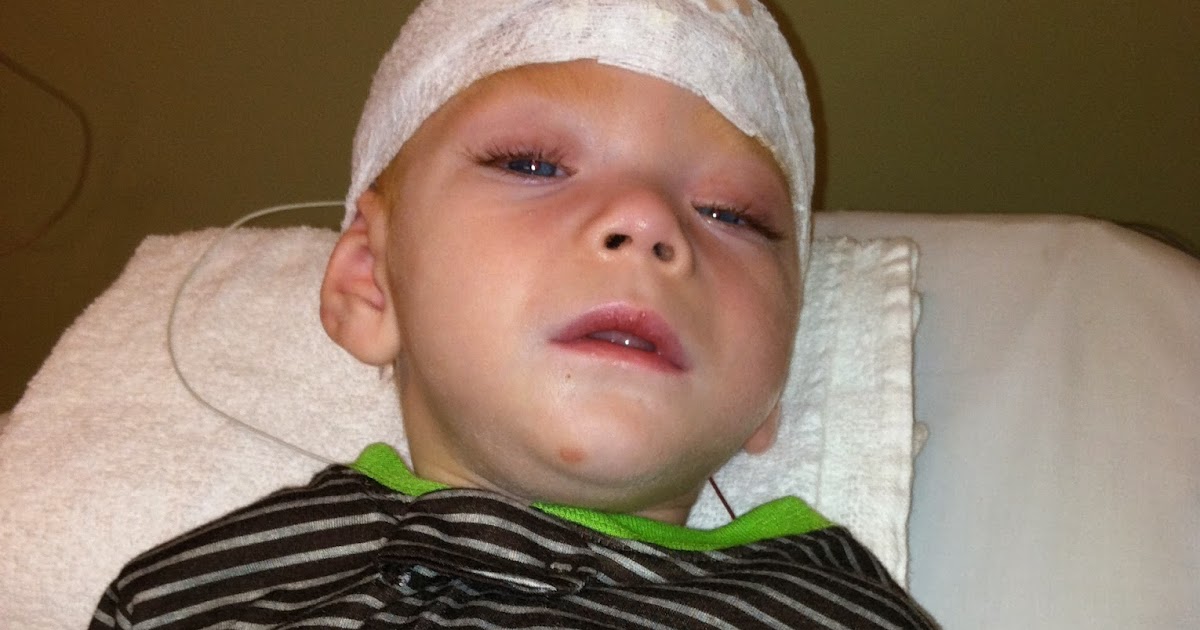 Loving Owen Lennox Gastaut Syndrome