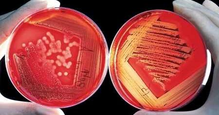 Exame triglicerides para que serve
