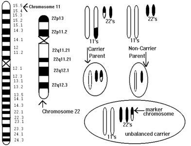 Cat Eye Syndrome Chromosome Cat Eye Syndrome Chromosome