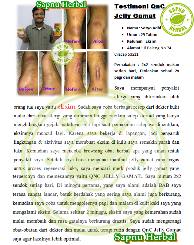 Obat Luka Gangren Tradisional Terampuh , Terbukti Manjur !! Obat Luka Gangren Tradisional Terampuh , Terbukti Manjur !!