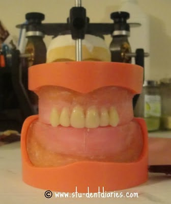 Stu-DENT Diaries: 10/01/2011 - 11/01/2011