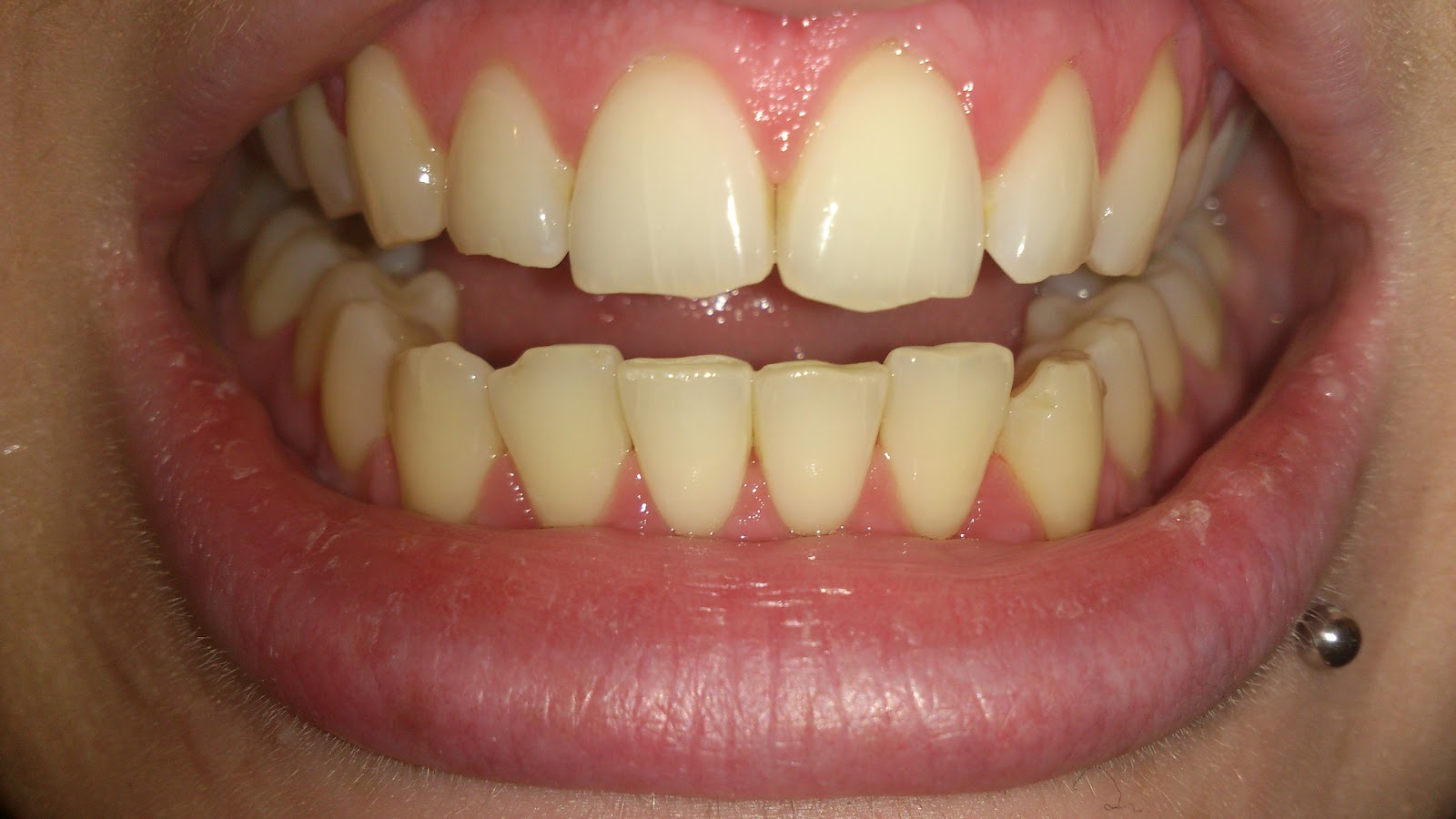 Crest 3D White Strips 2h Express Review Glasgow Beauty Blogger