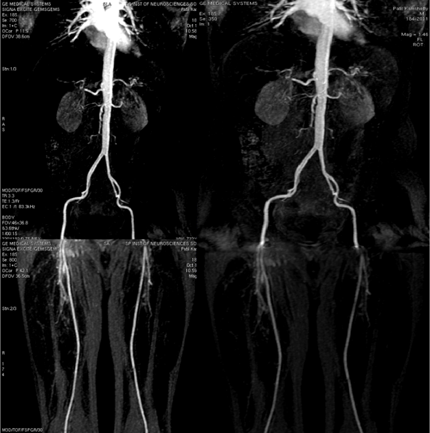 SPIN RADIOGRAPHERS Contrastenhanced MR angiography of abdominal aorta