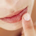 Πώς να βάψετε τα χείλη σας όταν είναι… σκασμένα;