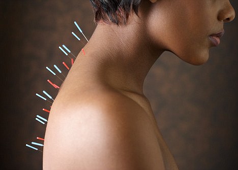 The Potential Risks Of Acupuncture