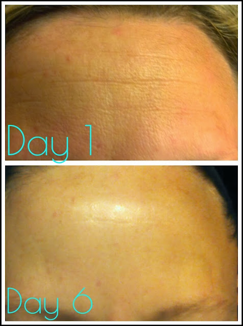 Unedited photo of REAL RESULTS from using NeriumAD for just 6 days. This is like "botox in a bottle!"