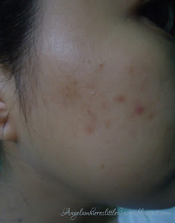 Shiseido White Lucent Skin Challenge Day4 Shiseido White Lucent Skin Challenge Day4